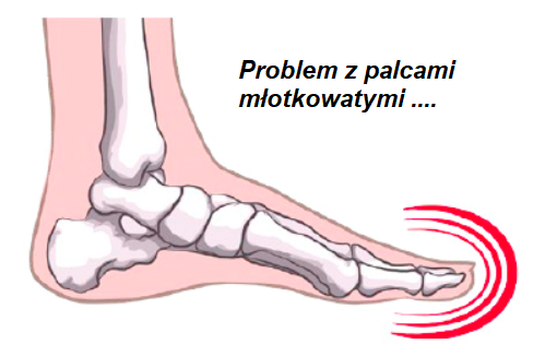 Painfull toes 01.png
