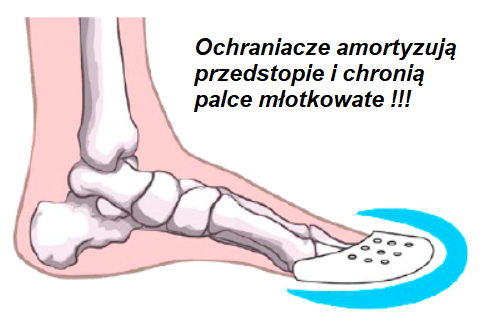 Painfull toes 02.png