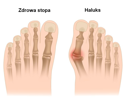 Haluks PL.png