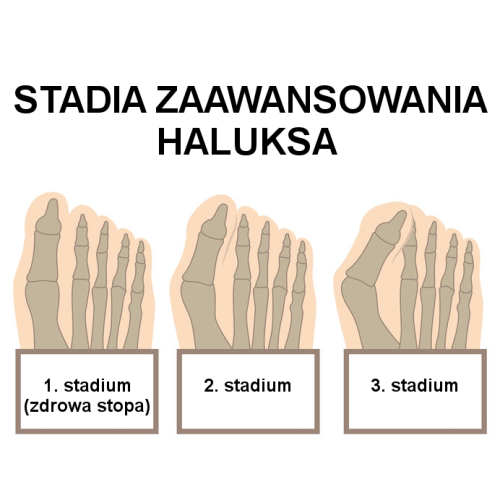 Haluks 2 PL.png